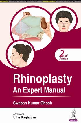 Ghosh |  Rhinoplasty | Buch |  Sack Fachmedien