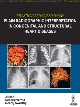 Verma / Awasthy |  Pediatric Cardiac Radiology | Buch |  Sack Fachmedien