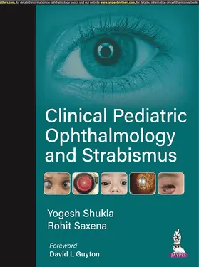 Shukla / Saxena |  Clinical Pediatric Ophthalmology and Strabismus | Buch |  Sack Fachmedien