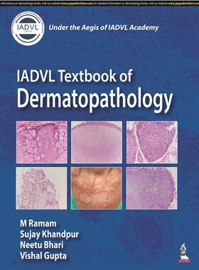 Ramam / Khandpur / Bhari |  IADVL Textbook of Dermatopathology | Buch |  Sack Fachmedien