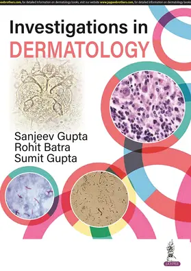 Gupta / Batra |  Investigations in Dermatology | Buch |  Sack Fachmedien