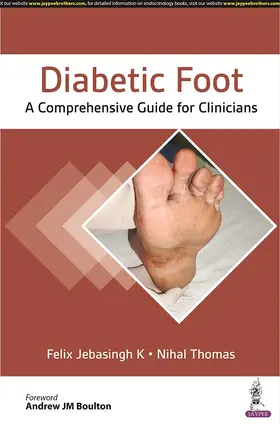 K / Thomas |  Diabetic Foot | Buch |  Sack Fachmedien