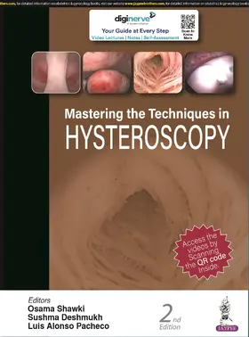 Shawki / Deshmukh / Pacheco |  Mastering the Techniques in Hysteroscopy | Buch |  Sack Fachmedien