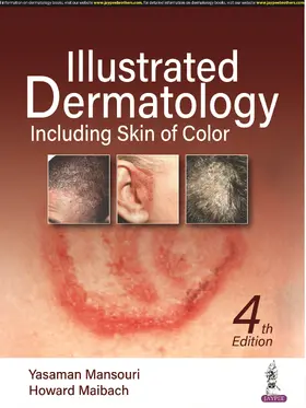 Maibach / Mansouri |  Illustrated Dermatology | Buch |  Sack Fachmedien