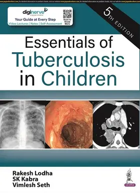 Lodha / Kabra / Seth |  Essentials of Tuberculosis in Children | Buch |  Sack Fachmedien