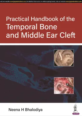 Bhalodiya |  Practical Handbook of the Temporal Bone and Middle Ear Cleft | Buch |  Sack Fachmedien