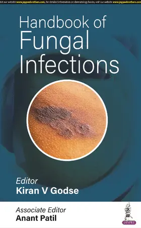 Patil / Godse |  Handbook of Fungal Infections | Buch |  Sack Fachmedien