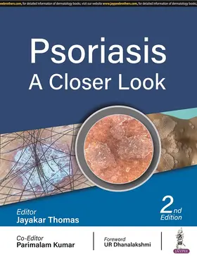 Thomas / Kumar |  Psoriasis | Buch |  Sack Fachmedien