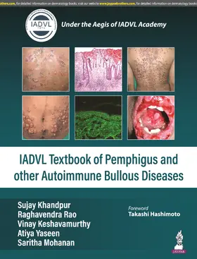 Khandpur / Rao / Yaseen | Textbook of Pemphigus and other Autoimmune Bullous Diseases | Buch | 978-93-5696-144-9 | sack.de