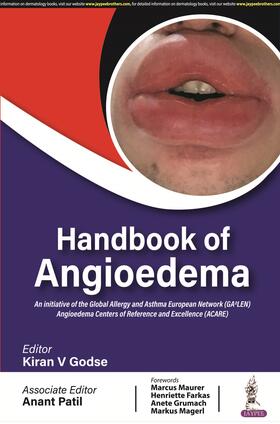 Godse / Patil |  Handbook of Angioedema | Buch |  Sack Fachmedien