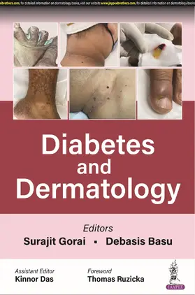 Gorai / Basu / Das |  Diabetes and Dermatology | Buch |  Sack Fachmedien