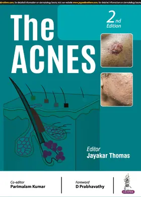 Thomas / Kumar |  The Acnes | Buch |  Sack Fachmedien