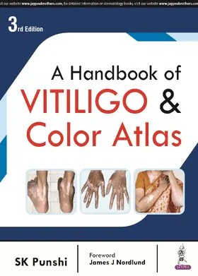 Punshi |  A Handbook of Vitiligo & Color Atlas | Buch |  Sack Fachmedien