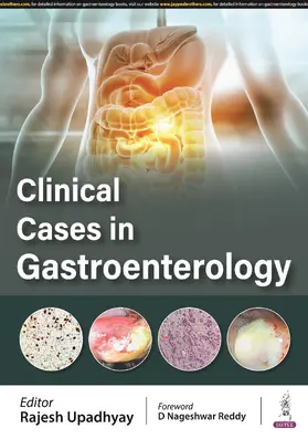 Upadhyay |  Clinical Cases in Gastroenterology | Buch |  Sack Fachmedien