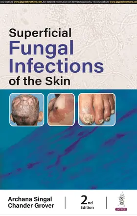 Singhal / Grover |  Superficial Fungal Infections of the Skin | Buch |  Sack Fachmedien