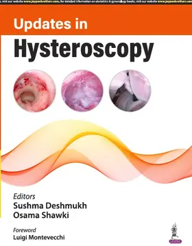 Deshmukh / Shawki |  Updates in Hysteroscopy | Buch |  Sack Fachmedien