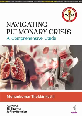 Thekkinkattil |  Navigating Pulmonary Crisis | Buch |  Sack Fachmedien