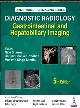 Sharma / Pradhan / Sandhu |  Diagnostic Radiology: Gastrointestinal and Hepatobiliary Imaging | Buch |  Sack Fachmedien