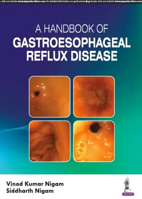 Nigam |  A Handbook of Gastroesophageal Reflux Disease (GERD) | Buch |  Sack Fachmedien