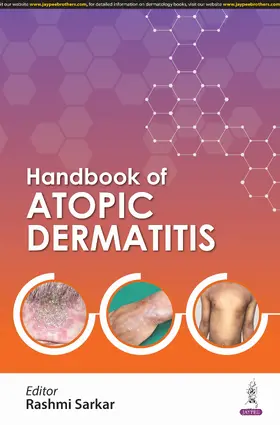 Sarkar |  Handbook of Atopic Dermatitis | Buch |  Sack Fachmedien