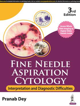 Dey |  Fine Needle Aspiration Cytology | Buch |  Sack Fachmedien