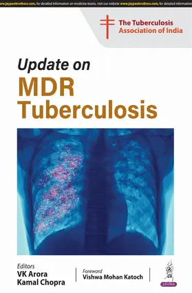 Arora / Chopra |  Update on MDR Tuberculosis | Buch |  Sack Fachmedien