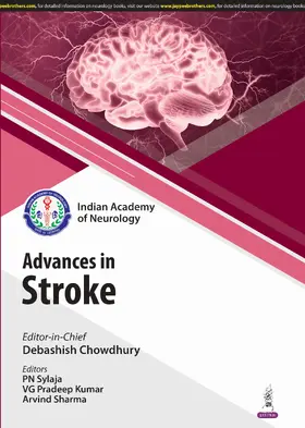 Chowdhury / Sylaja / Kumar |  Recent Advances in Stroke | Buch |  Sack Fachmedien