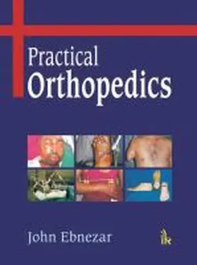 Ebnezar |  Practical Orthopedics | Buch |  Sack Fachmedien