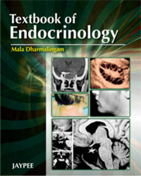 Dharmalingam |  Textbook of Endocrinology | Buch |  Sack Fachmedien