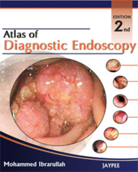 Ibrarullah |  Atlas of Diagnostic Endoscopy | Buch |  Sack Fachmedien