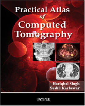 Singh / Kachewar |  Practical Atlas of Computed Tomography | Buch |  Sack Fachmedien