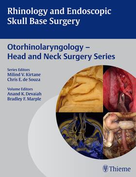 Devaiah / Marple |  Rhinology and Endoscopic Skull Base Surgery | Buch |  Sack Fachmedien