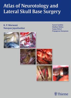 Morwani / Jayashankar |  Atlas of Neurotology and Lateral Skull Base Surgery | Buch |  Sack Fachmedien