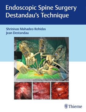 Rohidas / Destandau |  Endoscopic Spine Surgery | Buch |  Sack Fachmedien