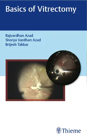 Azad / Takkar |  Basics of Vitrectomy | Buch |  Sack Fachmedien