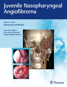 Janakiram / Wormald / Sharma |  Juvenile Nasopharyngeal Angiofibroma | Buch |  Sack Fachmedien