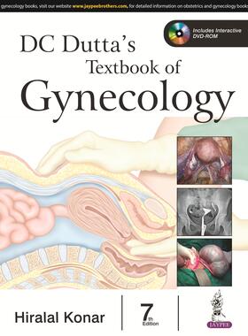 Konar |  DC Dutta's Textbook of Gynecology | Buch |  Sack Fachmedien