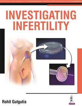 Garcia-Velasco / Banker / Gutgutia |  Infertility Management Series: Investigating Infertility | Buch |  Sack Fachmedien