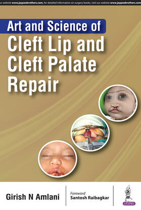 Amlani |  Art and Science of Cleft Lip and Cleft Palate Repair | Buch |  Sack Fachmedien