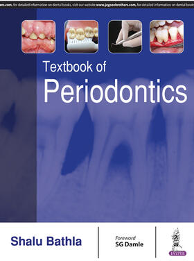 Bathla |  Textbook of Periodontics | Buch |  Sack Fachmedien