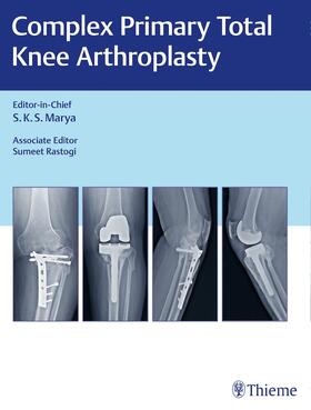 Marya / Rastogi |  Complex Primary Total Knee Arthroplasty | Buch |  Sack Fachmedien