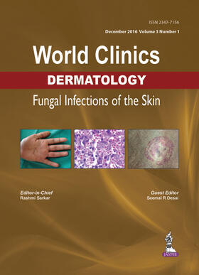 Sarkar / Desai |  World Clinics Dermatology: Fungal Infections of the Skin | Buch |  Sack Fachmedien