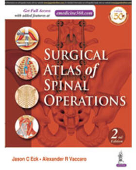 Eck / Vaccaro |  SURGICAL ATLAS OF SPINAL OPERA | Buch |  Sack Fachmedien