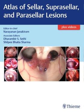 Janakiram / Sethi / Sharma |  Atlas of Sellar, Suprasellar and Parasellar Lesions | Buch |  Sack Fachmedien