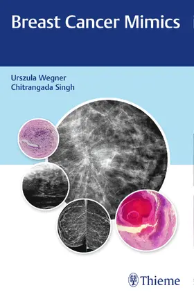 Wegner / Singh |  Breast Cancer Mimics | Buch |  Sack Fachmedien