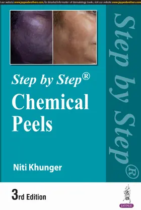 Khunger |  Step by Step: Chemical Peels | Buch |  Sack Fachmedien