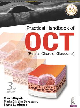 Lumbroso / Rispoli / Savastano |  Practical Handbook of OCT | Buch |  Sack Fachmedien