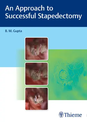 Gupta |  An Approach to Successful Stapedectomy | Buch |  Sack Fachmedien