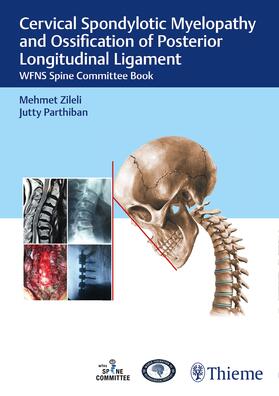 Zileli / Parthiban |  Cervical Spondylotic Myelopathy and Ossification of Posterior Longitudinal Ligament | Buch |  Sack Fachmedien