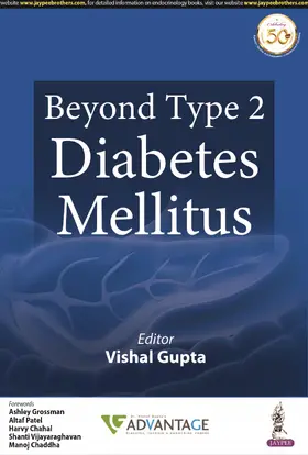 Gupta |  Beyond Type 2 Diabetes Mellitus | Buch |  Sack Fachmedien